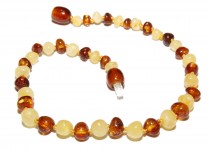 Adult-amber-anklet